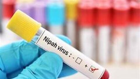 Ban hành tài liệu chuyên môn Hướng dẫn chẩn đoán và điều trị bệnh do vi rút Nipah