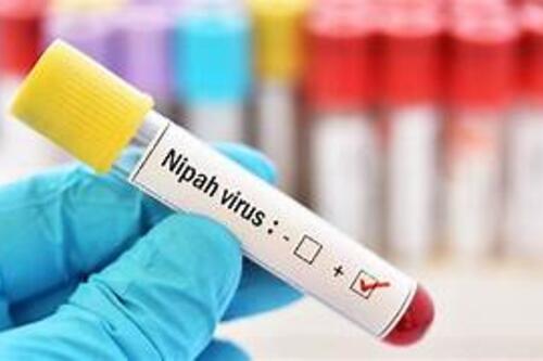 Ban hành tài liệu chuyên môn Hướng dẫn chẩn đoán và điều trị bệnh do vi rút Nipah