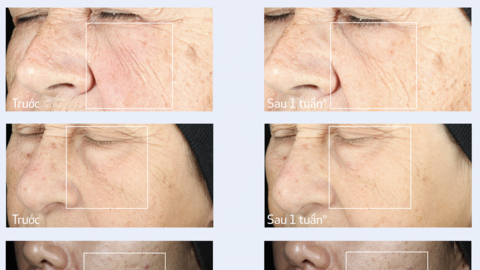 Hiểu đúng về lão hóa da từ cấp độ tế bào