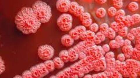 Bộ Y tế khuyến cáo phòng bệnh Whitmore