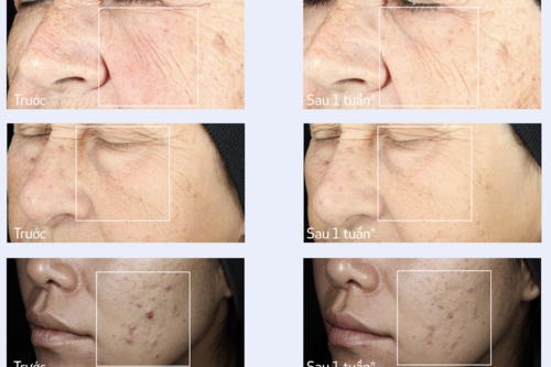 Hiểu đúng về lão hóa da từ cấp độ tế bào